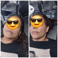 بند ابرو پاکسازی صورت