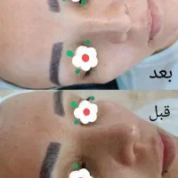 فیشیال تخصصی پوست به مدت محدود فقط۲۰۰تومن|خدمات آرایشگری و زیبایی|مشهد, طبرسی شمالی|دیوار