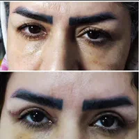 مرکز تخصصی جراحی بلفارو پلاستی دکتر الماس اسدی|خدمات آرایشگری و زیبایی|کرمانشاه, |دیوار