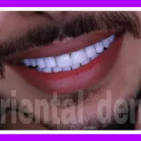 دندانپزشکی اقتصادی/کامپوزیت دندان/عصبکشی/ترمیم|خدمات آرایشگری و زیبایی|تهران, میدان ولیعصر|دیوار