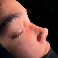عمل جراحی بینی با پیزو فقط23/ ترمیم/مشاوره رایگان|خدمات آرایشگری و زیبایی|تهران, ونک|دیوار