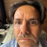 لیفت شقیقه توسط متخصص چشم تخفیف ویژه سه نفر اول|خدمات آرایشگری و زیبایی|تهران, تجریش|دیوار