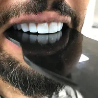 کامپوزیت زیبایی دندان|خدمات آرایشگری و زیبایی|شیراز, قصرالدشت|دیوار
