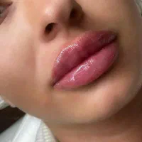 آموزش لابیا پلاستی کاشتمو ساکشن چربی|خدمات آموزشی|تهران, ستارخان|دیوار