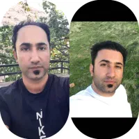 کلینیک تخصصی کاشت مو و ابرو