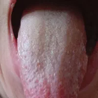 درمان و آموزش طب سنتی|خدمات آرایشگری و زیبایی|ماهان, |دیوار