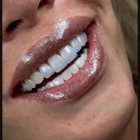 فقط با هشت میلیون کامپوزیت کن|خدمات زیبایی و سلامت|تهران, الهیه|دیوار