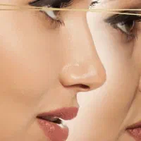 پروتز باسن/سینه تضمینی/ساکشن/غبغب اقساطی|خدمات آرایشگری و زیبایی|تهران, شهرک غرب|دیوار