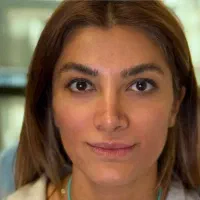 رفع لک صورت رفع چروک گردن فیلر بادی جوانسازی دست