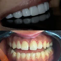 جشنواره پائیز کامپوزیت لمینت|خدمات آرایشگری و زیبایی|تهران, مدائن|دیوار