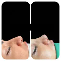 جراحی های زیبایی درپرتو کلینیک