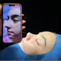 جشنواره عمل بینی با ۳۰ تومان
