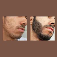 راز پرپشتی ریش و مو