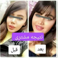 پودر جوانه گندم/چاقی صورت/آبرسان/بوتاکس/اصل|آرایشی، بهداشتی، درمانی|رشت, دیلمان|دیوار