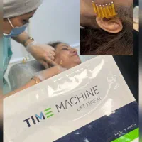 لیزرموهای زائد،ژل وبوتاکس،پی آرپی.فیلربادی،بلفارو|خدمات زیبایی و سلامت|تهران, شکوفه|دیوار