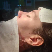 با۲۴تومن عمل زیبایی بینی کن جمعه