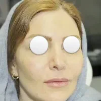 جشنواره سه روزه تخفیف جوانسازی پوست و مو