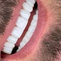 فرصت استثنایی زیبایی و لاغری، تخفیف به مدت محدود|خدمات آرایشگری و زیبایی|اهواز, کیانپارس |دیوار