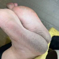 پدیکور تخصصی و درمانی|خدمات آرایشگری و زیبایی|باسمنج, |دیوار