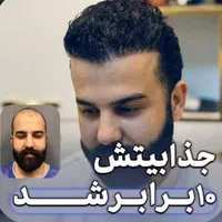 کاشت مو با جدید ترین تکنیک