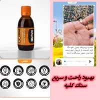 دفع سنگ کلیه
