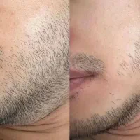 این آخرین روشیه که امتحان میکنی