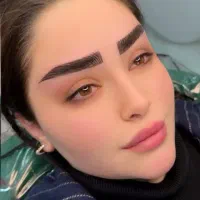 انجام خدمات میکرو فیبروز شیدینگ لب خط چشم