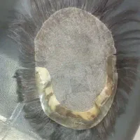 پروتز مو در حد نو|آرایشی، بهداشتی، درمانی|فردیس, فردیس|دیوار