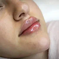 فیلر و بوتاکس