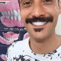 دندان طررح لمینت  وطبیعی بانازلترین قیمتیکروزه