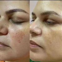 بیوممتیک ایتالیایی اصل