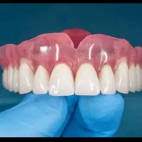 دست  دندان  طرح لمینیت