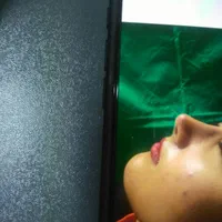 مطب دکتر حجت شکرگزار جراح کاشت دندان و جراحی بینی|خدمات آرایشگری و زیبایی|اردبیل, |دیوار