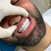 جشنواره کامپوزیت کرج