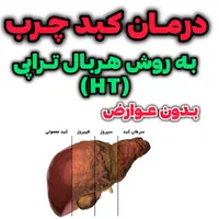 کبد چرب