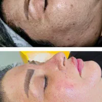 فیشیال مزوتراپی الکترولیز پاکسازی و آموزش در مطب|خدمات آرایشگری و زیبایی|اهواز, گلستان|دیوار