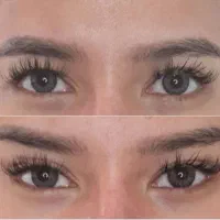 بوتاکس پیشانی،بوتاکس چشم گربه ای، لیزر موهای زائد|خدمات آرایشگری و زیبایی|خسروشاه, |دیوار