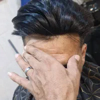 پروتز مو|خدمات آرایشگری و زیبایی|دزفول, |دیوار