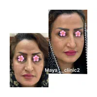 کلینیک زیبایی پوست و مو مایا|خدمات آرایشگری و زیبایی|ماهدشت, |دیوار