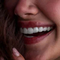 اوردنچر کامپوزیت ایمپلنت ارتودنسی اقساط بدون سود