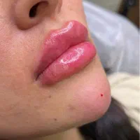 آموزش تخصصی ژل و بوتاکس|خدمات آموزشی|تهران, تهرانپارس شرقی|دیوار