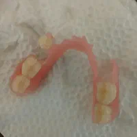 ساخت دندان مصنوعی در سنندج548276|خدمات آرایشگری و زیبایی|نورآباد, |دیوار