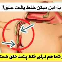 خلط پشت حلق