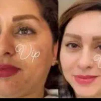 کرم VIP اصل