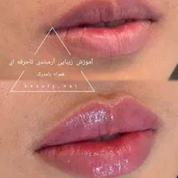 خدمات ژل وبوتاکس /کاشت مووابرو/باکمترین قیمت