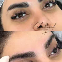 اجاره ورنت لیزر کیوسوییچپیکوشور بااپراتور حرفه ای|پزشکی|تهران, اقدسیه|دیوار