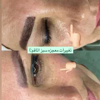 فیشال انواع پوست با قیمت مناسب