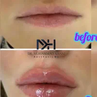 بیماریاب مطب زیبایی