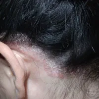 پوستت اگه مشکل داره به ما بسپار