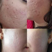 کلینیک زیبایی دکتر سعیدجوانسازی پوست و تناسب اندام